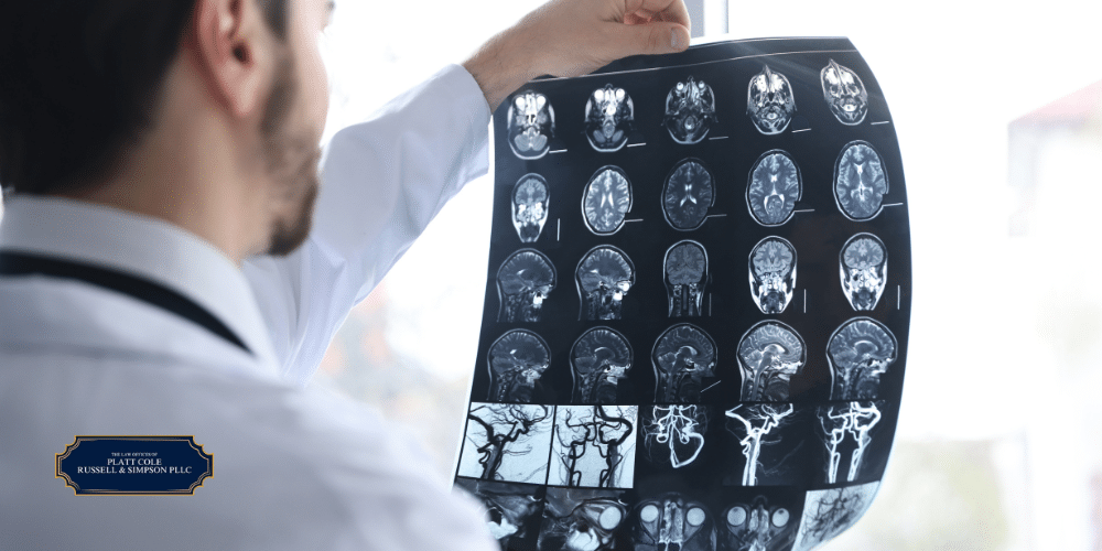 brevard county brain injury lawyer