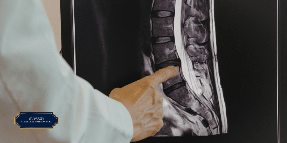 spinal cord damage lawyer attorney melbourne, fl